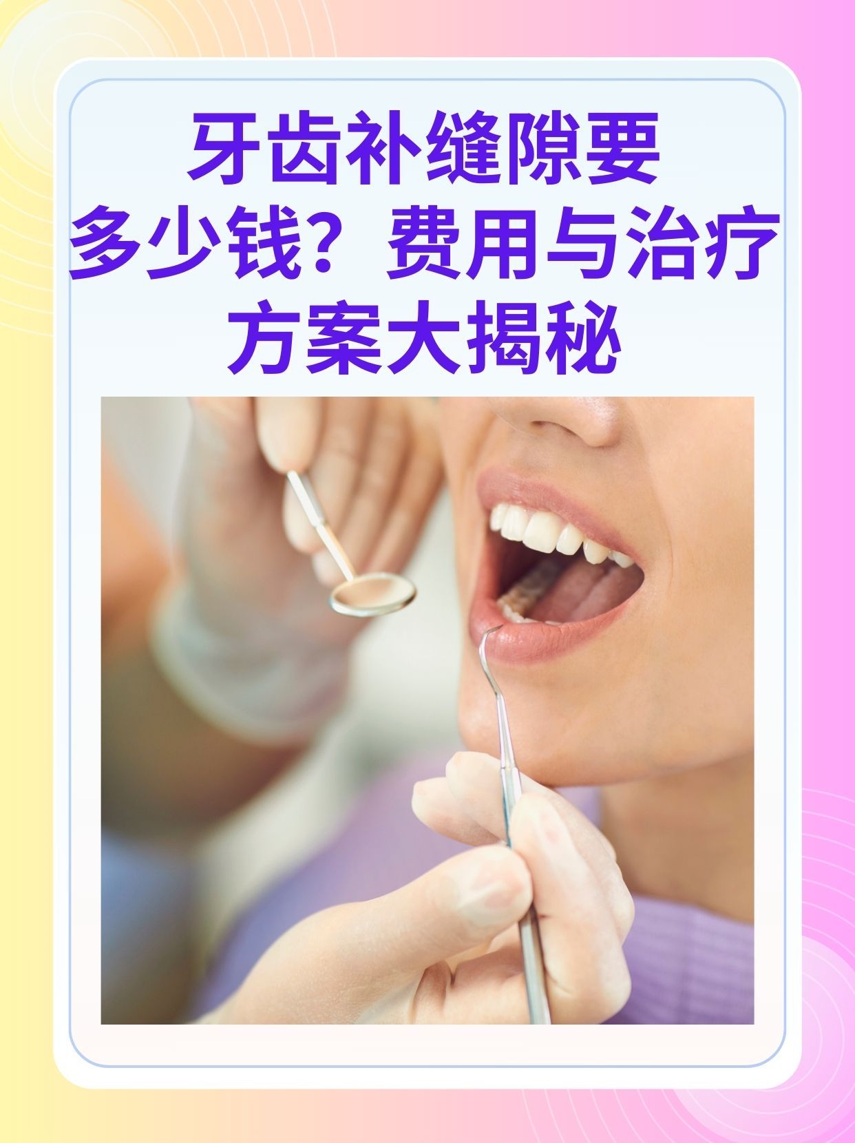 淮安补牙医保可以报销吗(补牙医保可以报销吗 哪些可以报销呢)